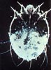 Scabies (Sarcoptic Mange)