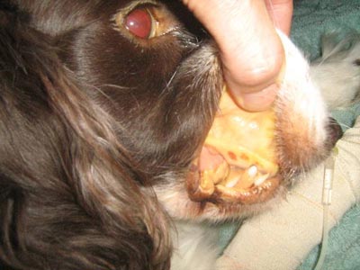 Ketika Sistem Antibodi Menyerang